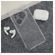 maska skin silikon za honor pura 80 pro/ 80 pro plus transparent-maska-skin-silikon-za-honor-pura-80-pro-80-pro-plus-transparent-169581-312144-169581.png